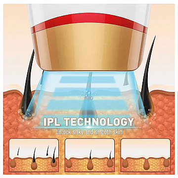 ����� ���� ����� ���� IPL ���: MC-1280
